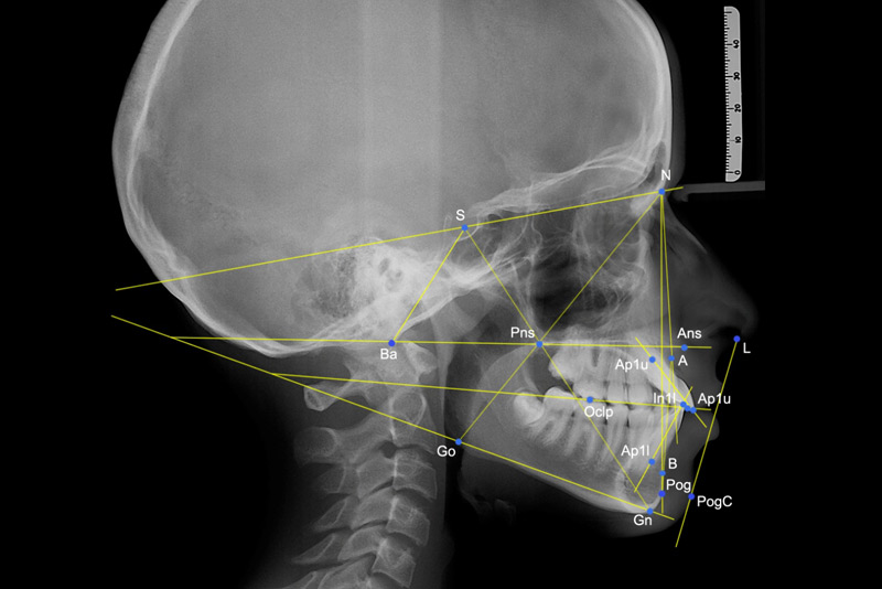 Ejemplo de Imagen informativa