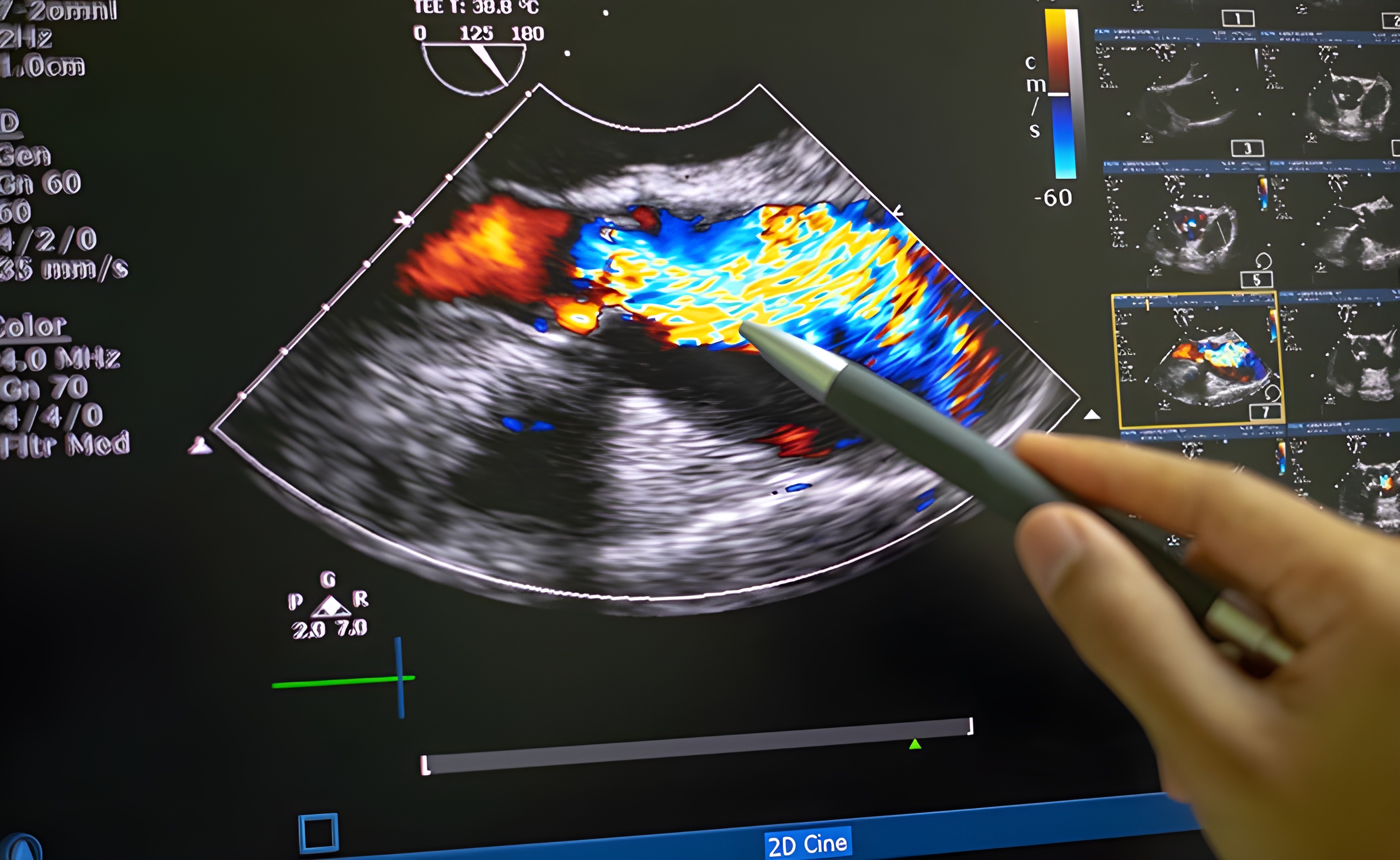 Ejemplo de Imagen informativa