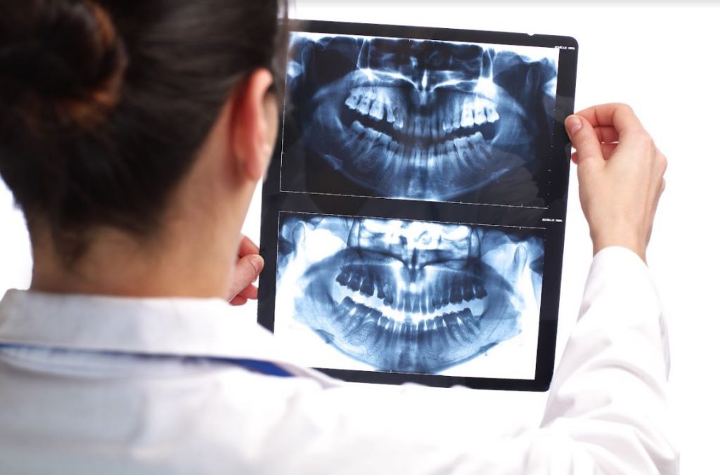 Ejemplo de Imagen informativa