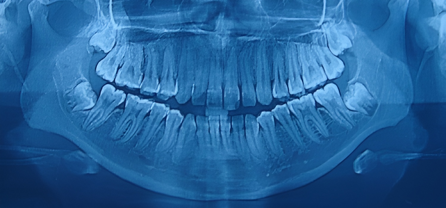 Ejemplo de Imagen informativa