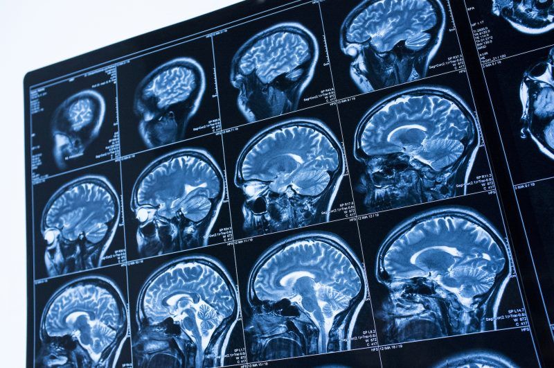 Ejemplo de Imagen informativa