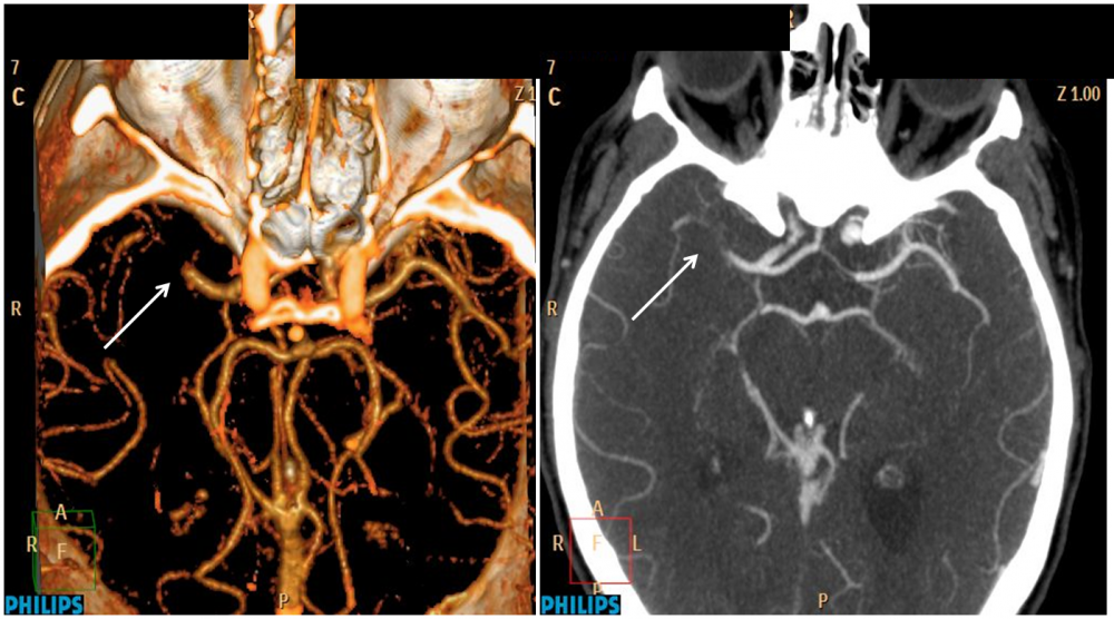 Ejemplo de Imagen informativa