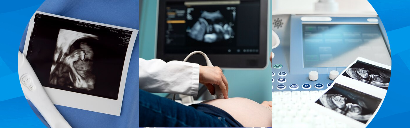 Ejemplo de Imagen informativa