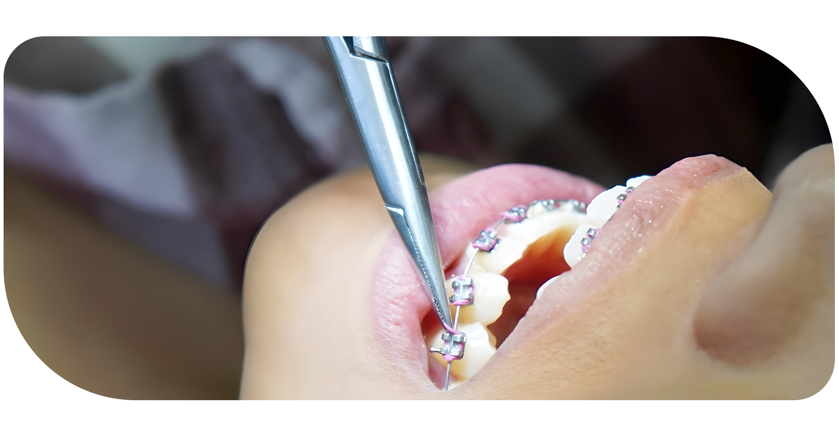 Ejemplo de Imagen dentistarmativa 3