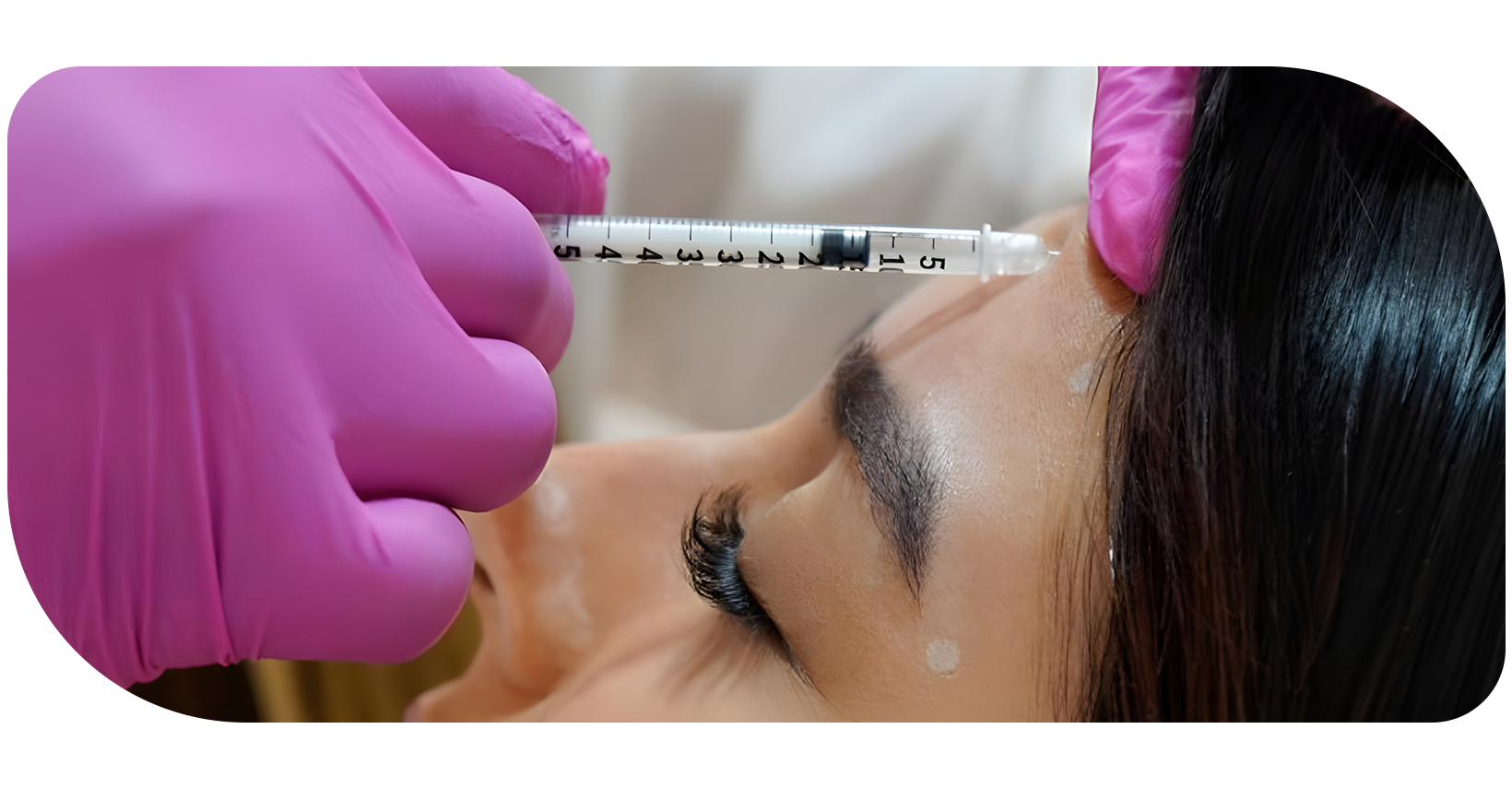 Ejemplo de Imagen medestrmativa