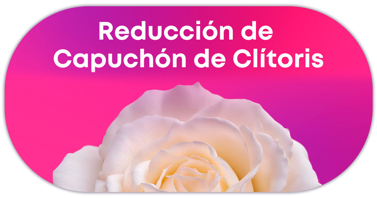 Ejemplo de Imagen Aqui