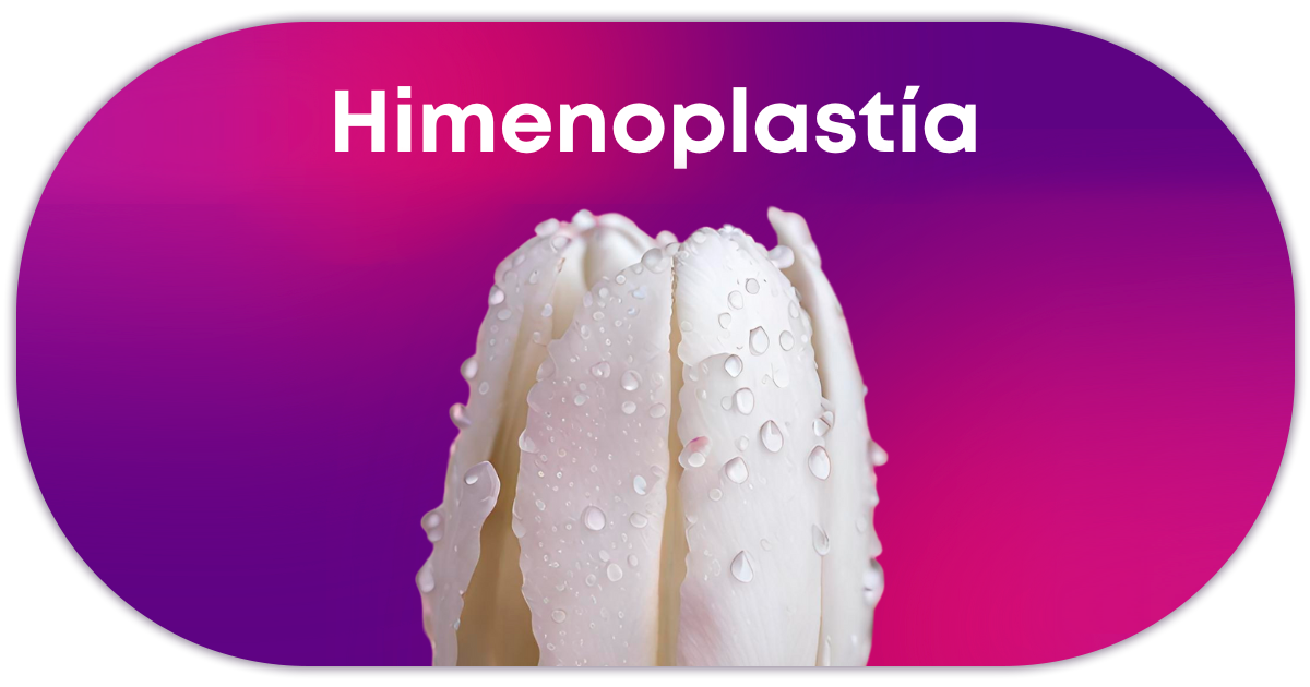 Ejemplo de Imagen Aqui