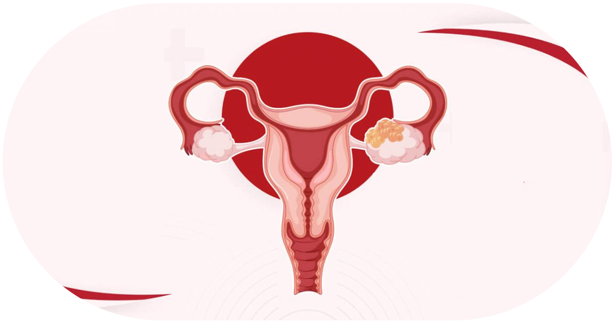 Ejemplo de Imagen informativa