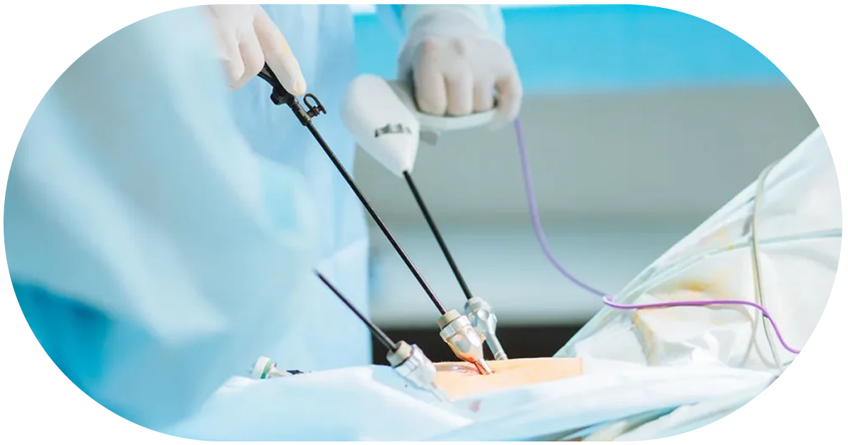 Ejemplo de Imagen informativa