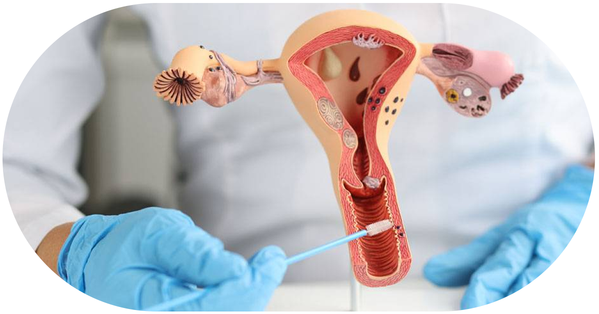 Ejemplo de Imagen informativa