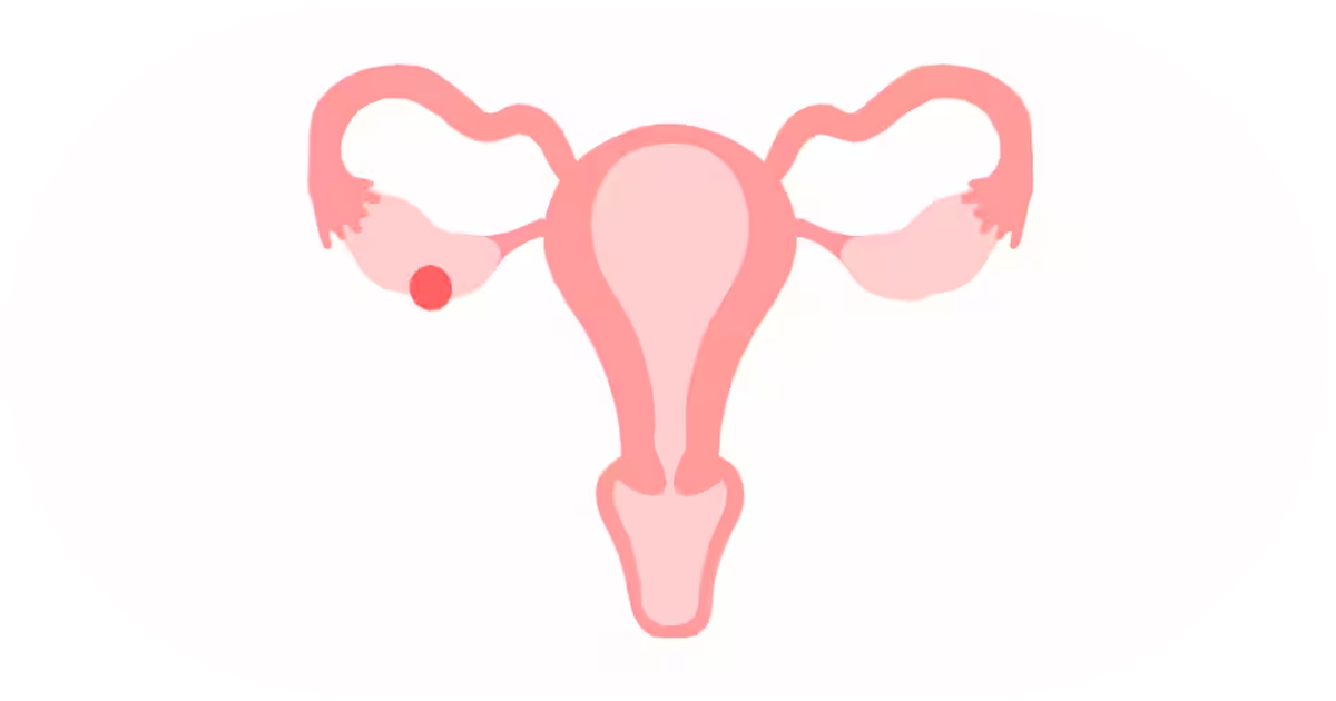 Ejemplo de Imagen informativa