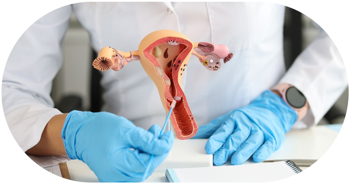 Ejemplo de Imagen informativa