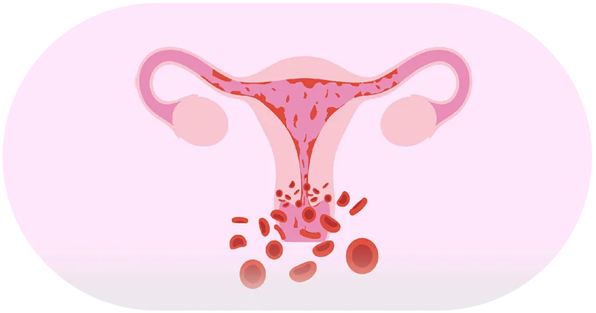 Ejemplo de Imagen informativa